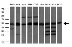 eRF1 Antibody (OTI2E3), Novus Biologicals 0.1mL; Unlabeled:Antibodies,