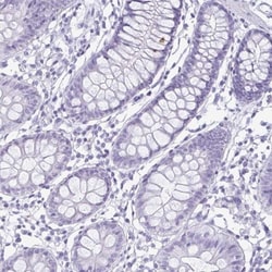 enkurin Antibody, Novus Biologicals:Antibodies:Primary Antibodies
