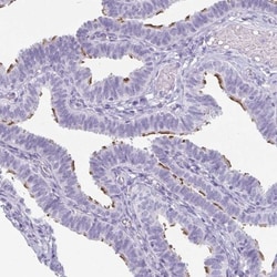 enkurin Antibody, Novus Biologicals:Antibodies:Primary Antibodies