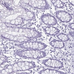 enkurin Antibody, Novus Biologicals:Antibodies:Primary Antibodies