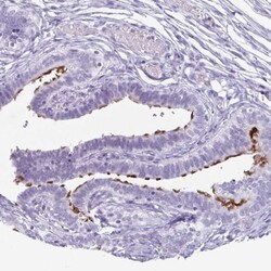 enkurin Antibody, Novus Biologicals:Antibodies:Primary Antibodies