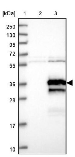 enkurin Antibody, Novus Biologicals 25 &mu;L | Buy Online | Novus Biologicals | Fisher Scientific
