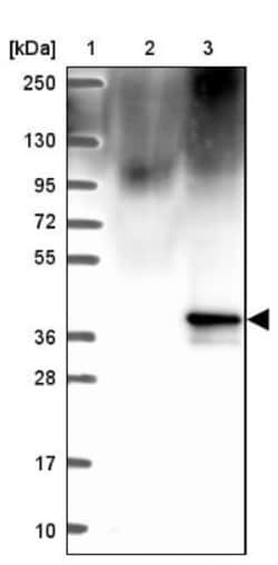enkurin Antibody, Novus Biologicals:Antibodies:Primary Antibodies