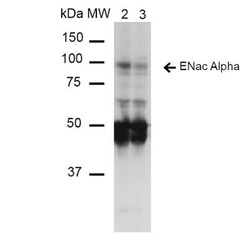 epithelial Sodium Channel beta Antibody (14E10), Novus Biologicals 25 &mu;g;