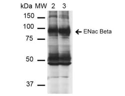 epithelial Sodium Channel beta Antibody (16E4), Novus Biologicals:Antibodies:Primary