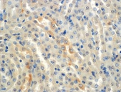 epithelial Sodium Channel alpha Antibody (2G4), Novus Biologicals:Antibodies:Primary