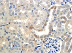 epithelial Sodium Channel beta Antibody (7B8), Novus Biologicals 100&mu;g;