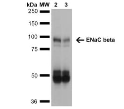 epithelial Sodium Channel beta Antibody (7B8), Novus Biologicals 100&mu;g;