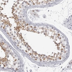 espin Antibody, Novus Biologicals 25 &mu;L | Buy Online | Novus Biologicals | Fisher Scientific