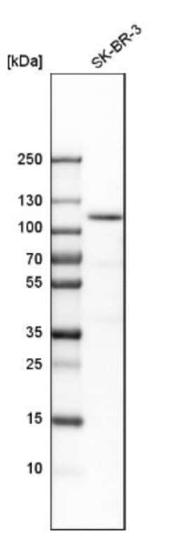 espin Antibody, Novus Biologicals 25 &mu;L | Buy Online | Novus Biologicals | Fisher Scientific
