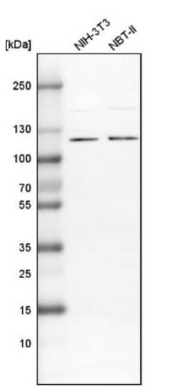 espin Antibody, Novus Biologicals 25 &mu;L | Buy Online | Novus Biologicals | Fisher Scientific