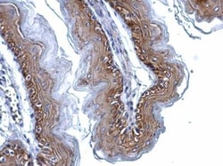 gamma Catenin Antibody, Novus Biologicals 0.1mL; Unlabeled:Antibodies,