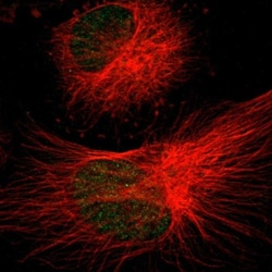 gamma Sarcoglycan Antibody, Novus Biologicals 25 &mu;L; Unlabeled:Antibodies,