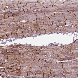 gamma Sarcoglycan Antibody, Novus Biologicals 25 &mu;L; Unlabeled:Antibodies,