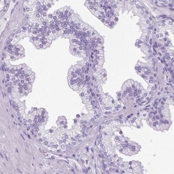 gamma Sarcoglycan Antibody, Novus Biologicals 25 &mu;L; Unlabeled:Antibodies,