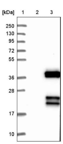 gamma Sarcoglycan Antibody, Novus Biologicals 25 &mu;L; Unlabeled:Antibodies,