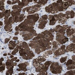 gamma-Synuclein Antibody, Novus Biologicals 0.1mL; Unlabeled:Antibodies,