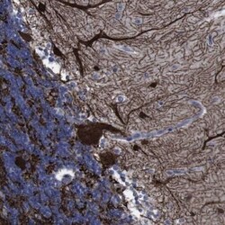 gamma-Synuclein Antibody, Novus Biologicals 0.1mL; Unlabeled:Antibodies,