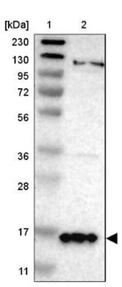 gamma-Synuclein Antibody, Novus Biologicals 0.1mL; Unlabeled:Antibodies,