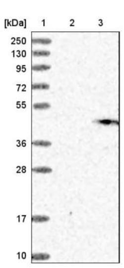 gamma-glutamyl hydrolase Antibody, Novus Biologicals 0.1 mL | Buy Online | Novus Biologicals | Fisher Scientific