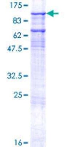 Novus Biologicals Recombinant Human gtf3c3 GST (N-Term) Protein 25 &mu;g | Buy Online | Novus Biologicals&trade; | Fisher Scientific