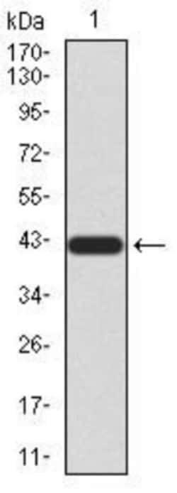 Rad23 Antibody (1E4D6) - BSA Free, Novus Biologicals 0.1mg; Unlabeled:Antibodies,