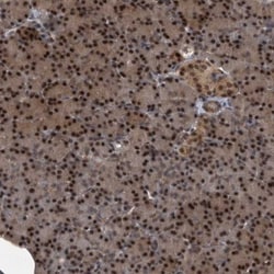 hHR23b Antibody, Novus Biologicals 0.1mL; Unlabeled:Antibodies, Polyclonal