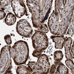hHR23b Antibody, Novus Biologicals 0.1mL; Unlabeled:Antibodies, Polyclonal