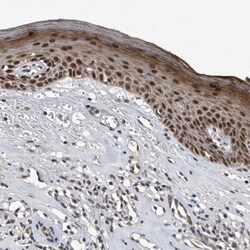 hHR23b Antibody, Novus Biologicals 0.1mL; Unlabeled:Antibodies, Polyclonal