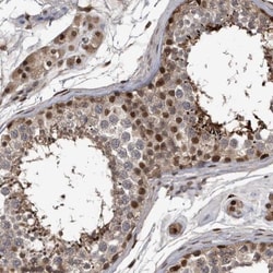 hHR23b Antibody, Novus Biologicals 0.1mL; Unlabeled:Antibodies, Polyclonal