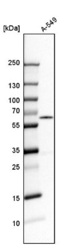 hHR23b Antibody, Novus Biologicals 0.1mL; Unlabeled:Antibodies, Polyclonal