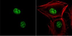 hHpr1-p84-Thoc1 Antibody (5E10), Novus Biologicals 0.1mg; Unlabeled:Antibodies,