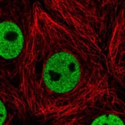 hnRNP C1 + C2 Antibody (CL2593), Novus Biologicals 0.1mL; Unlabeled:Antibodies,
