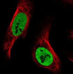 hnRNP C1 + C2 Antibody (CL2593), Novus Biologicals 0.1mL; Unlabeled:Antibodies,