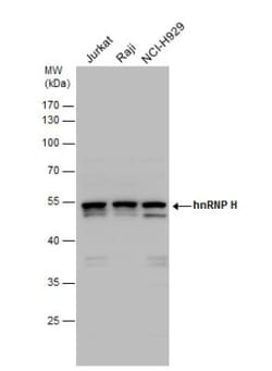 hnRNP H Antibody, Novus Biologicals 0.1mg; Unlabeled:Antibodies, Polyclonal