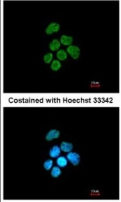 hnRNP K Antibody, Novus Biologicals 0.1mg; Unlabeled:Antibodies, Polyclonal