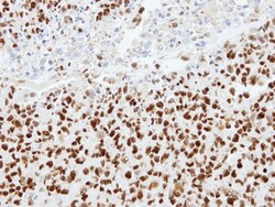 hnRNP K Antibody, Novus Biologicals 0.1mg; Unlabeled:Antibodies, Polyclonal