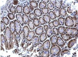 hnRNP K Antibody, Novus Biologicals 0.1mg; Unlabeled:Antibodies, Polyclonal