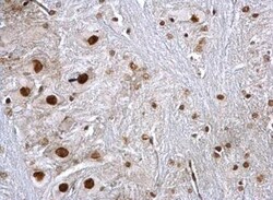 hnRNP K Antibody, Novus Biologicals 0.1mg; Unlabeled:Antibodies, Polyclonal