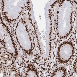 hnRNP L Antibody, Novus Biologicals:Antibodies:Primary Antibodies