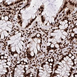 hnRNP L Antibody, Novus Biologicals:Antibodies:Primary Antibodies