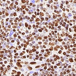 hnRNP M1-M4 Antibody (1D8), Novus Biologicals:Antibodies:Primary Antibodies