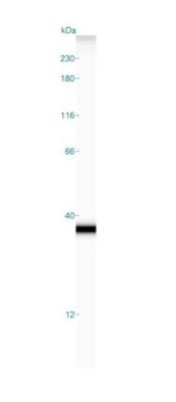 hydroxysteroid (17-beta) dehydrogenase 11 Antibody, Novus Biologicals 0.1mL;