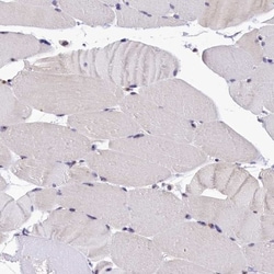integrin beta 4 binding protein Antibody, Novus Biologicals 0.1mL; Unlabeled:Antibodies,