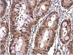 integrin beta 4 binding protein Antibody, Novus Biologicals 0.1mL; Unlabeled:Antibodies,