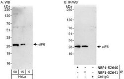 integrin beta 4 binding protein Antibody, Novus Biologicals 0.1mg; Unlabeled:Antibodies,