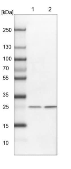 integrin beta 4 binding protein Antibody, Novus Biologicals 0.1mL; Unlabeled:Antibodies,