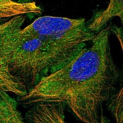 katanin-p80 Antibody, Novus Biologicals 0.1mL; Unlabeled:Antibodies, Polyclonal