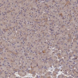 katanin-p80 Antibody, Novus Biologicals 0.1mL; Unlabeled:Antibodies, Polyclonal