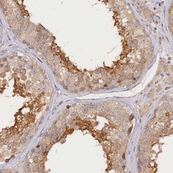 katanin-p80 Antibody, Novus Biologicals 0.1mL; Unlabeled:Antibodies, Polyclonal